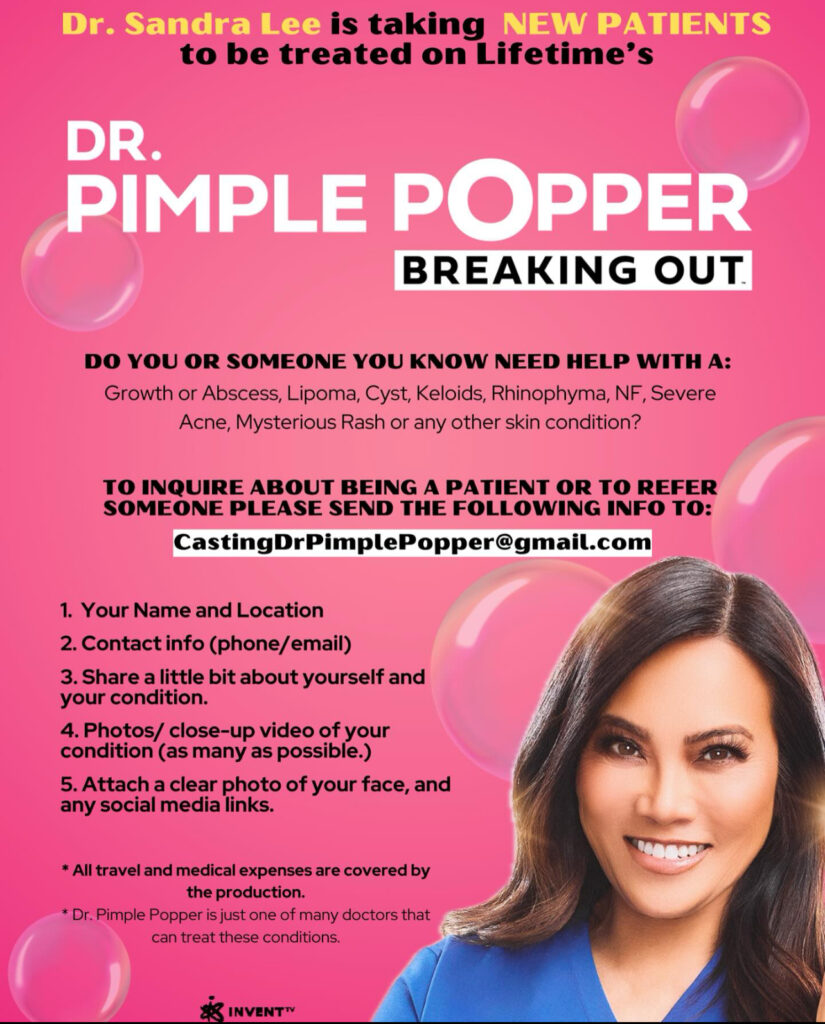 Pimple Popper casting call