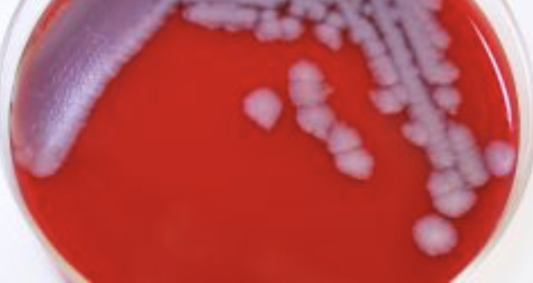 Anthrax Incident at CDC Narrowly Averted Disaster